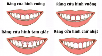 Nhìn tướng răng cửa dự đoán vận số: Tướng răng nào may mắn nhất?