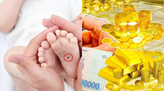 Hiếm ai có: Nốt ruồi ở vị trí này tài lộc Trời ban như bùa hộ mệnh, giữ là phúc, xóa là mất lộc