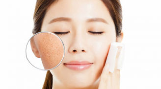 Điểm danh những sự thật quan trọng về lỗ chân lông mà bạn nên biết