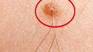 4 vị trí đột nhiên mọc lông gia chủ ngồi không hưởng lộc, tiền bạc ào ào tới