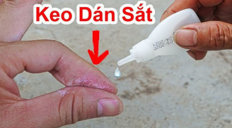 Keo 502 dính vào tay rửa mãi không sạch: Ngâm tay vào thứ này là bong ra luôn, không bị rách da