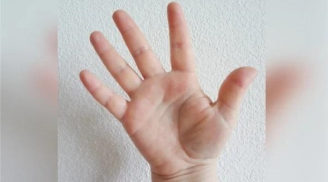 Nhìn tướng tay biết ai tiền bạc rủng rỉnh, càng có tuổi càng viêm mãn