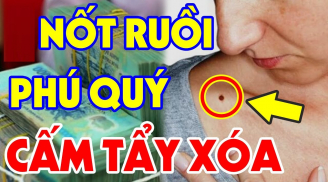4 nốt ruồi phú quý nhiều người 'muốn có cũng không được', có 1/4 chẳng lo thiếu tiền