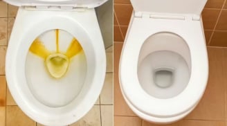 Loại bỏ vết cặn vôi, ố vàng trong bồn cầu chỉ trong 5 phút với nguyên liệu tự nhiên, hiệu quả hơn thuốc tẩy