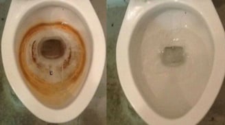 Bồn cầu bám cặn vàng: Không cần cọ rửa nhiều, làm cách này trắng sáng, thơm tho như mới