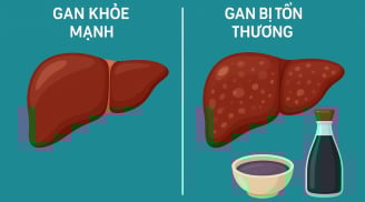 Cảnh báo: Loại gia vị quen thuộc này có thể âm thầm hại gan mà nhiều người Việt chưa biết