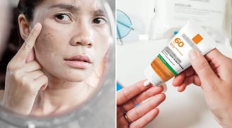 Sai lầm khi thoa kem chống nắng làm da sạm nám nhiều hơn