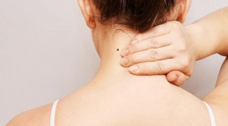 3 nốt ruồi tài lộc, hút vàng hút bạc ai may mắn lắm mới sở hữu