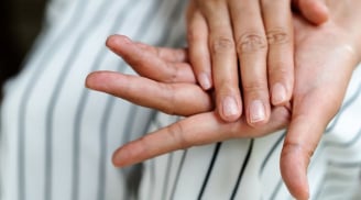 Cảnh báo: Móng tay có hình dạng kỳ lạ có thể là dấu hiệu ung thư nguy hiểm