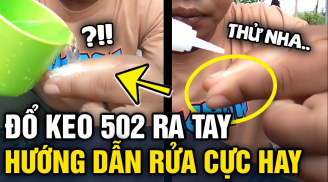 Cách gỡ keo 502 dính trên tay và đồ dùng nhanh nhất, không lo phồng rộp