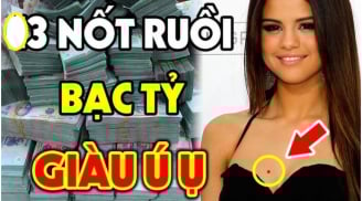 3 nốt ruồi là Hố Chôn Tiền: Ai có được hút bạc tỷ, đừng dại xóa đi