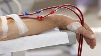 7 dấu hiệu suy thận giai đoạn cuối: Chủ quan tính mạng tính bằng tháng