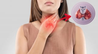Ung thư tuyến giáp là mối đe dọa âm thầm: 6 có nhóm người dễ mắc bệnh này, nhất định phải thận trọng