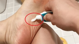 Bôi kem đánh răng vào lòng bàn chân trước khi ngủ, việc nhỏ mà lợi ích to