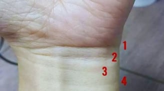 Nhìn vào 4 ngấn cổ tay: Biết ngay cuộc đời sung sướng Tiền Nhiều hay Nghèo Khổ