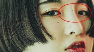 4 nốt ruồi hao tài: Ai có dù tài ba tới mấy cũng khó thoát nghèo