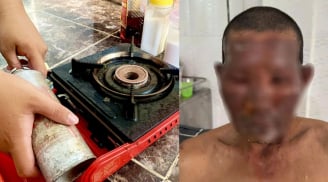 Bình gas mini phát nổ, 8 người nhập viện, lưu ý cách dùng để tránh họa bình gas mini