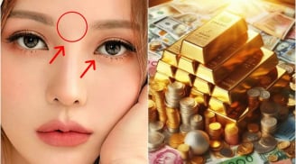 Người có 3 điểm này trên mặt Điềm Báo Phát Tài: Tiền vào như nước, thăng quan giàu có
