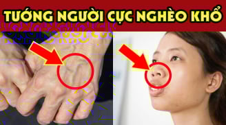 Người có 3 nét tướng này càng sống càng Bạc Phúc: Trẻ thì ốm đau hao tài, già thì cô độc nghèo khổ