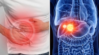 “2 đau 1 vàng” dấu hiệu cảnh báo ung thư gan đang âm thầm phát triển: Chủ quan tính mạng tính từng ngày