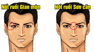 4 nốt ruồi phá hủy Phúc Lộc: Ai có tuổi trẻ gian nan, cuối đời túng thiếu cô độc