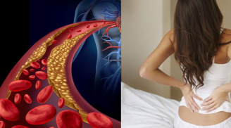 Người gầy vẫn bị mỡ máu cao vì những lý do này