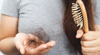 Càng ăn 5 loại thực phẩm này, tóc càng rụng nhiều: Món số 1 được nhiều người yêu thích