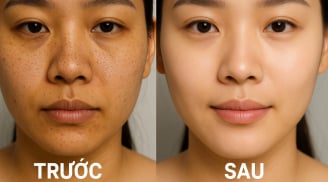 Rửa mặt bằng giấm gạo: Bí quyết làm đẹp 'ngon, bổ, rẻ' giúp da sáng căng, mờ mụn chỉ sau vài tuần