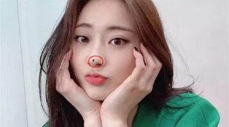 3 nốt ruồi chặn tài lộc: Ai không có thật đáng chúc mừng