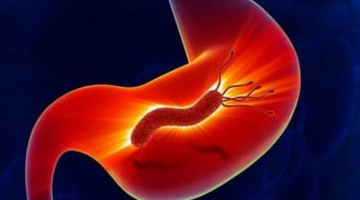 6 dấu hiệu tưởng nhẹ nhưng là 'mồi nhử' ung thư: Đừng chủ quan nếu bạn mắc phải