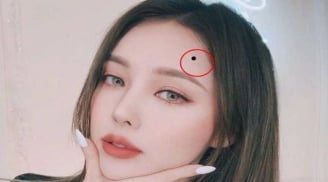 Nốt ruồi phát tài nằm ở đâu? Thầy tướng số tiết lộ: Ai sở hữu, tiền vào như nước, giàu sang khó tránh