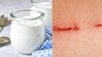 Nghiên cứu mới: Làm Gel trị thương từ sữa chua