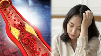 4 việc giúp làm sạch mạch máu, ngăn ngừa lão hóa