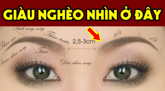 Người có điểm này trên mặt: Cực kỳ may mắn, Trúng Số Giàu To, đó là gì?