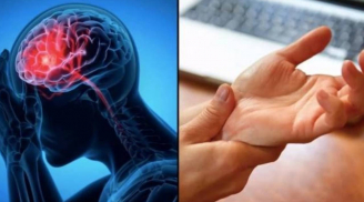 Dấu hiệu cảnh báo đột quỵ trước một tuần tuyệt đối đừng bỏ qua