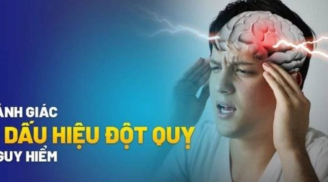7 dấu hiệu cảnh báo đột quỵ trước 1 tuần: Nhận biết sớm để cứu mạng