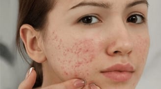 5 tác hại khi không rửa mặt sau khi đắp mặt nạ mà nhiều người không ngờ tới