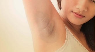 7 mẹo là “cứu tinh” giúp bạn vừa trị thâm, vừa khử mùi hiệu quả