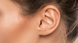 Nốt ruồi son là gì? Giải mã nốt ruồi son ở từng vị trí trên cơ thể