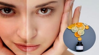 Vitamin C và những sai lầm thường gặp khi chăm sóc da