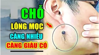 3 chỗ mọc lông Ngồi Không cũng có Tiền, số 1 nhiều người không biết lại nhổ đi