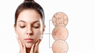 Nguyên tắc “sáng C – tối A” hồi sinh làn da nhiều khuyết điểm