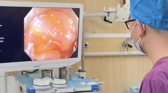 22 tuổi mắc ung thư kết tràng: Thói quen xấu đang âm thầm ‘bào mòn’ ruột non giới trẻ