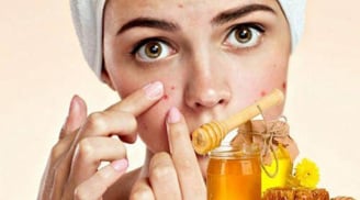 Mật ong hoàn toàn có thể trở thành “trợ thủ” cho da mụn nếu nàng nắm rõ những điểm sau
