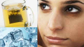 Cách giảm thâm quầng mắt chỉ cần trà và đá lạnh