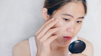 5 hoạt chất chống lão hóa cần thiết cho làn da sau tuổi 30