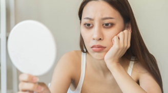 Chuyên gia bật mí tuyệt chiêu đỡ thâm và bọng mắt nhanh chóng