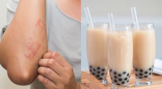 3 món ngọt âm thầm phá hủy lá gan, nhiều người Việt vẫn vô tư ăn hằng ngày