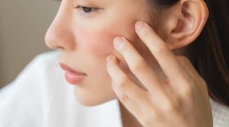 4 thói quen tưởng chừng vô hại nhưng lại khiến da dễ sạm nám