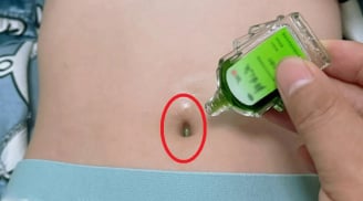 Bôi 1 giọt dầu gió vào rốn trước khi ngủ, tránh cả đống bệnh
